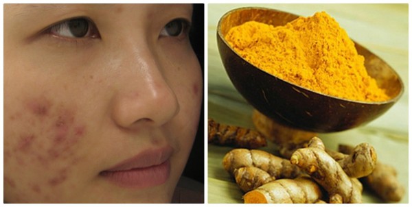 Nghệ - 