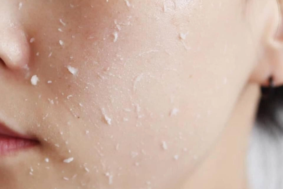 Xua tan nỗi lo da khô, xỉn màu ở tuổi mãn kinh