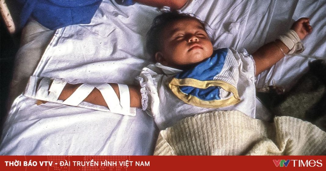 ca-1110nid-cholera-peru-online-27901091380579591937793-14285786534666153239887.jpg
