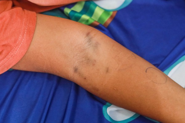 Con muốn sống: Bé trai ung thư 'xin mẹ sinh em khác để con được chết' Con muốn sống: Bé trai ung thư 'xin mẹ sinh em khác để con được chết'