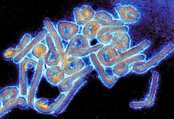 Ethiopia bùng phát virus Marburg, tỷ lệ tử vong cao ngang Ebola Ethiopia bùng phát virus Marburg, tỷ lệ tử vong cao ngang Ebola