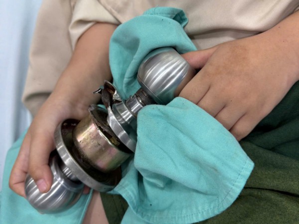 Bác sĩ 'hóa thợ khóa' cứu bé trai 5 tuổi kẹt ngón tay vào ổ khóa