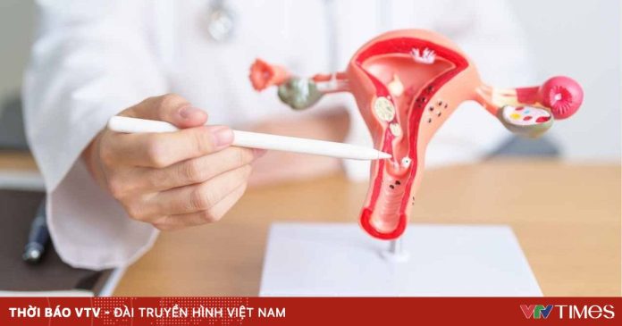 Tháng Nâng cao nhận thức về ung thư cổ tử cung: Căn bệnh có thể phòng ngừa Tháng Nâng cao nhận thức về ung thư cổ tử cung: Căn bệnh có thể phòng ngừa