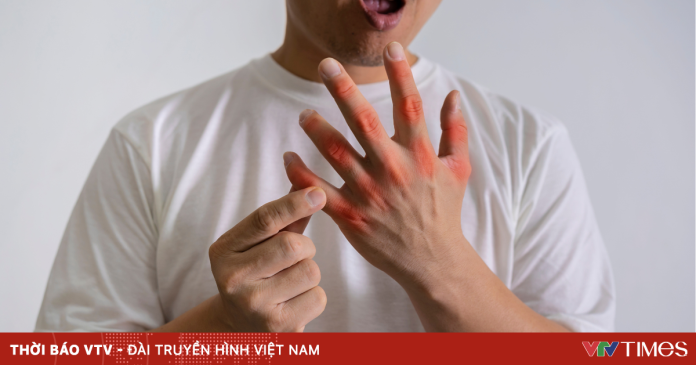 3 bệnh lý chuyển hóa thường gặp sau Tết 3 bệnh lý chuyển hóa thường gặp sau Tết