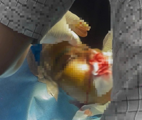 TP.HCM: Một người tử vong sau khi làm đẹp bằng phương pháp 'truyền trắng da'