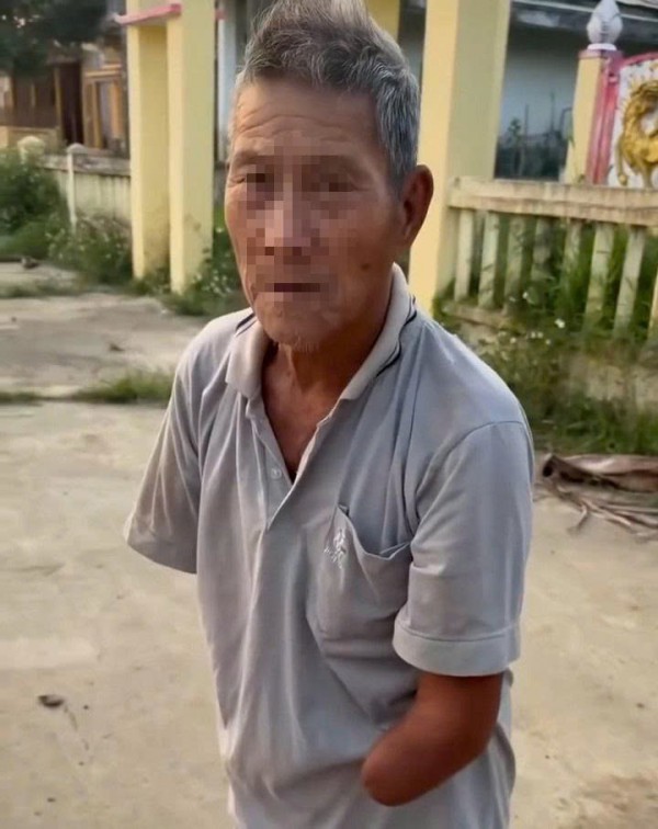 Cụ ông cụt 2 tay kẹp rắn hổ mang đã xuất viện sau 4 ngày điều trị Cụ ông cụt 2 tay kẹp rắn hổ mang đã xuất viện sau 4 ngày điều trị