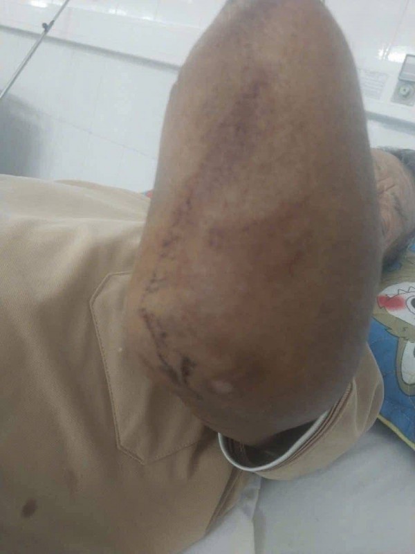 Cụ ông cụt 2 tay kẹp rắn hổ mang đem về nhà, con trai kể lại khoảnh khắc khó tin Cụ ông cụt 2 tay kẹp rắn hổ mang đem về nhà, con trai kể lại khoảnh khắc khó tin