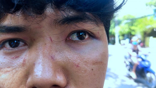 Hành hung người bán bánh bèo ở Quy Nhơn: Con trai cũng bị đánh Hành hung người bán bánh bèo ở Quy Nhơn: Con trai cũng bị đánh