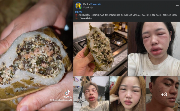 Bánh trứng kiến đang 'hot' mạng: Có người phải nhập viện vì dị ứng, ai cần tránh? Bánh trứng kiến đang 'hot' mạng: Có người phải nhập viện vì dị ứng, ai cần tránh?
